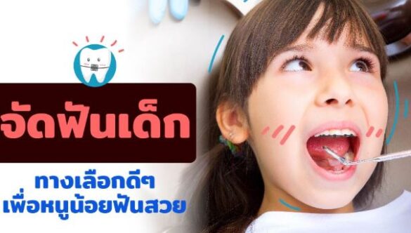 การจัดฟันเด็ก ทางเลือกดีๆเพื่อหนูน้อยฟันสวย