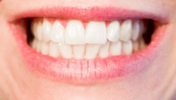 ประเภทของฟันปลอมและการดูแลรักษาฟันปลอม