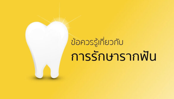 ข้อควรรู้ เกี่ยวกับการ รักษารากฟัน ก่อนจะสายเกินไป