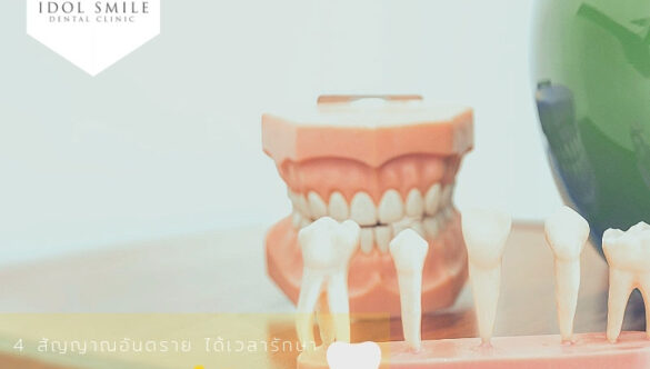 ทันตกรรมน่ารู้  รักษา “ รากฟัน ” ด้วยตัวคุณเอง