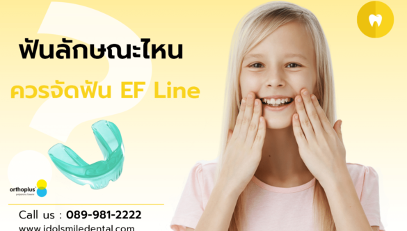 ฟันลักษณะไหน ควรจัดฟัน EF Line