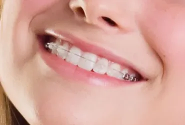 iTopPlus525860243654