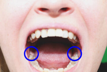 istockphoto-1138884083-612x612