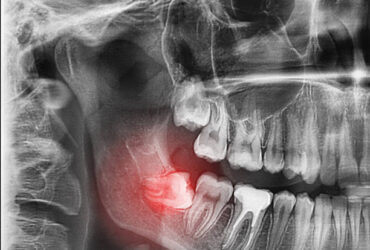 istockphoto-1182509269-612x612