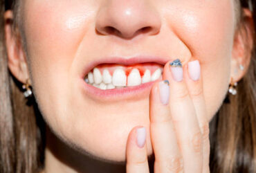 istockphoto-โรงเหงือก1296755375-612x612