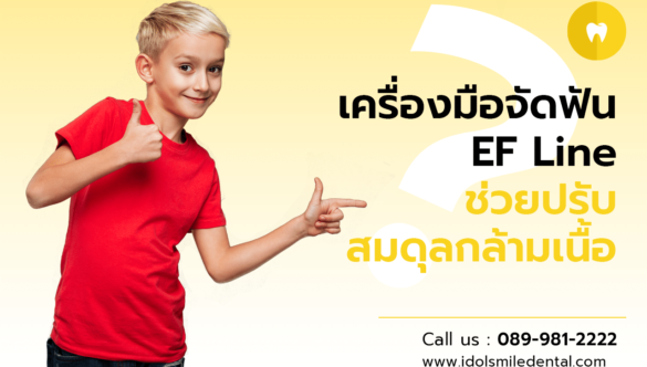 เครื่องมือจัดฟัน EF Line ช่วยปรับสมดุลกล้ามเนื้อ