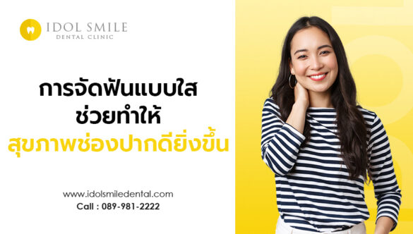 การจัดฟันแบบใส ช่วยทำให้สุขภาพช่องปากดียิ่งขึ้น
