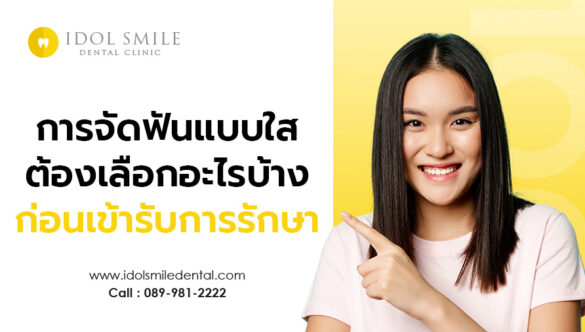 การจัดฟันแบบใส ต้องเลือกอะไรบ้างก่อนเข้ารับการรักษา