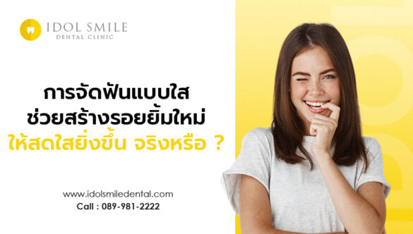 การจัดฟันแบบใส ช่วยสร้างรอยยิ้มใหม่ ให้สดใสยิ่งขึ้น จริงหรือ ?