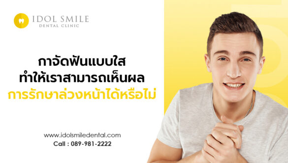 กาจัดฟันแบบใส ทำให้เราสามารถเห็นผลการรักษาล่วงหน้าได้หรือไม่