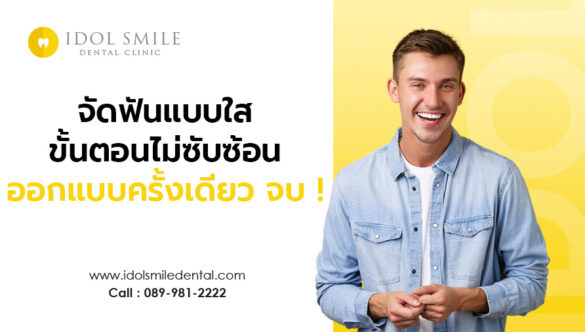 จัดฟันแบบใส ขั้นตอนไม่ซับซ้อน ออกแบบครั้งเดียว จบ