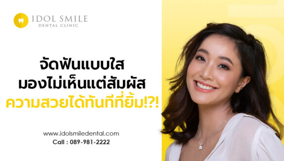 จัดฟันแบบใส มองไม่เห็นแต่สัมผัสความสวยได้ทันทีที่ยิ้ม