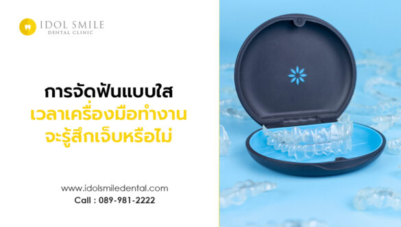 การจัดฟันแบบใส เวลาเครื่องมือทำงาน จะรู้สึกเจ็บหรือไม่