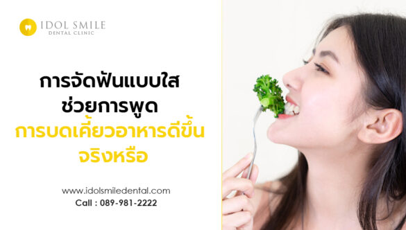 การจัดฟันแบบใส ช่วยการพูด การบดเคี้ยวอาหารดีขึ้น จริงหรือ