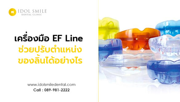 เครื่องมือ EF Line ช่วยปรับตำแหน่งของลิ้นได้อย่างไร