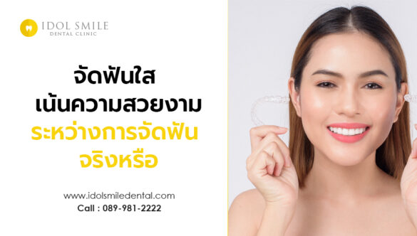 จัดฟันใส เน้นความสวยงามระหว่างการจัดฟัน จริงหรือ
