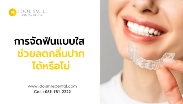 การจัดฟันแบบใส ช่วยลดกลิ่นปากได้หรือไม่