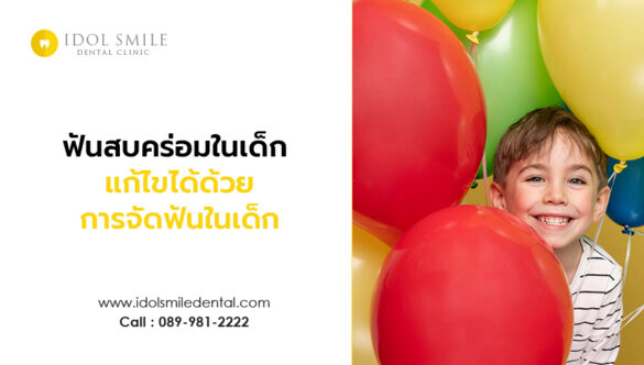 ฟันสบคร่อมในเด็ก แก้ไขได้ด้วยการจัดฟันในเด็ก