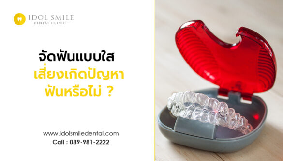 จัดฟันแบบใส เสี่ยงเกิดปัญหาฟันหรือไม่