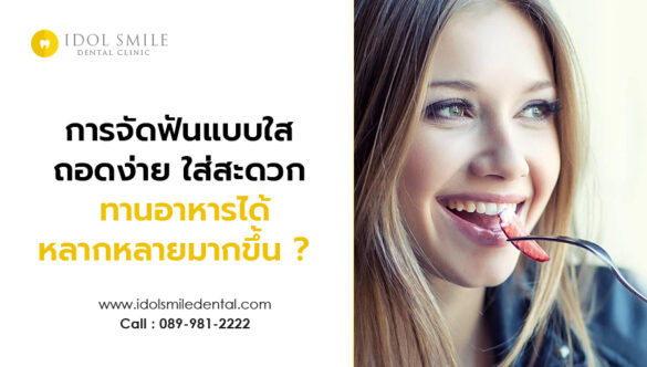 การจัดฟันแบบใส ถอดง่าย ใส่สะดวก รับประทานอาหารได้หลากหลายมากขึ้น