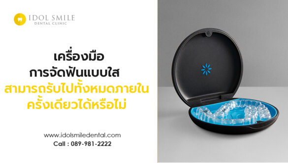 เครื่องมือการจัดฟันแบบใส สามารถรับไปทั้งหมดภายในครั้งเดียวได้หรือไม่