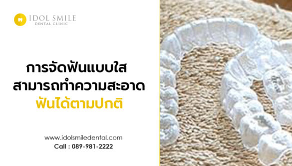 การจัดฟันแบบใส สามารถสาามารถทำความสะอาดฟันได้ตามปกติ