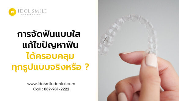 การจัดฟันแบบใส สามารถแก้ไขปัญหาฟันได้ครอบคลุมทุกรูปแบบ จริงหรือไม่