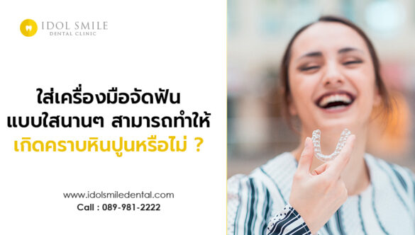 ใส่เครื่องมือการจัดฟันแบบใสนานๆ สามารถทำให้เกิดคราบหินปูนหรือไม่