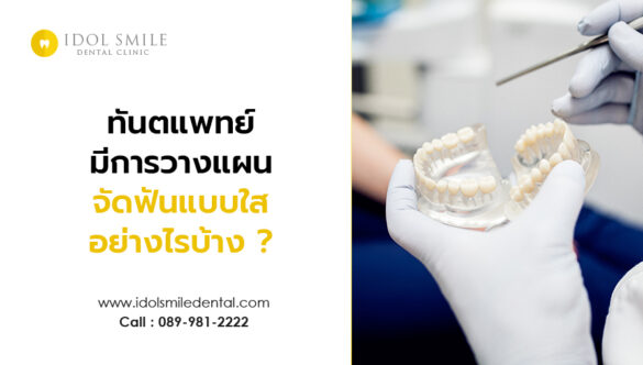 ทันตแพทย์มีการวางแผนจัดฟันแบบใส อย่างไรบ้าง