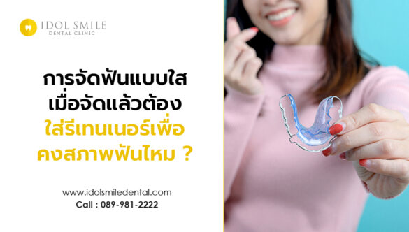 การจัดฟันแบบใส เมื่อจัดแล้วต้องใส่รีเทนเนอร์เพื่อคงสภาพฟันไหม