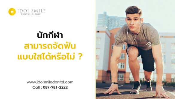 นักกีฬา สามารถจัดฟันแบบใสได้หรือไม่