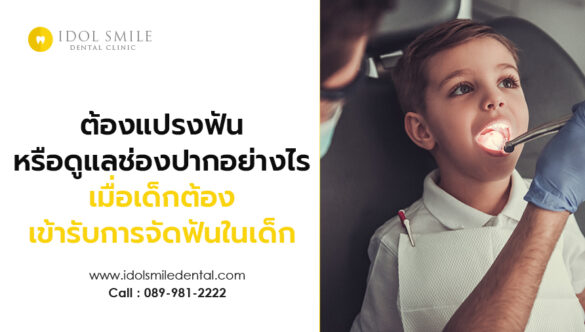 ต้องแปรงฟันหรือดูแลช่องปากอย่างไร เมื่อเด็กต้องเข้ารับการจัดฟันในเด็ก