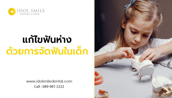แก้ไขฟันห่าง ด้วยการจัดฟันในเด็ก