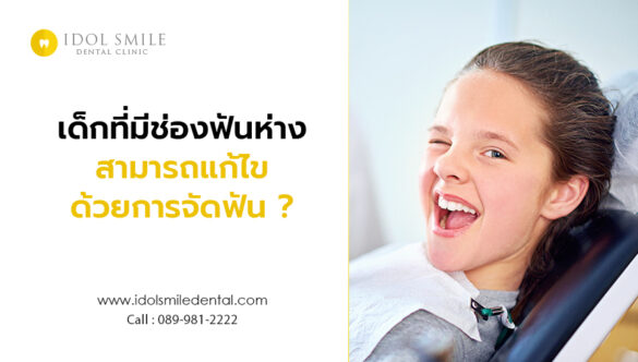 เด็กที่มีช่องฟันห่าง  สามารถแก้ไขด้วยการจัดฟัน