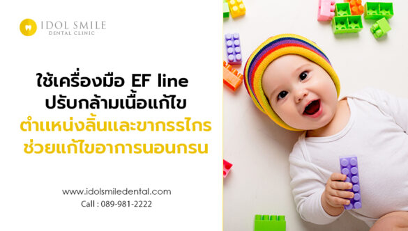 ใช้เครื่องมือ EF line ปรับกล้ามเนื้อแก้ไขตำเเหน่งลิ้น เเละขากรรไกร ช่วยแก้ไขอาการนอนกรน