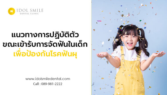 แนวทางการปฏิบัติตัว ขณะเข้ารับการจัดฟันในเด็ก เพื่อป้องกันโรคฟันผุ