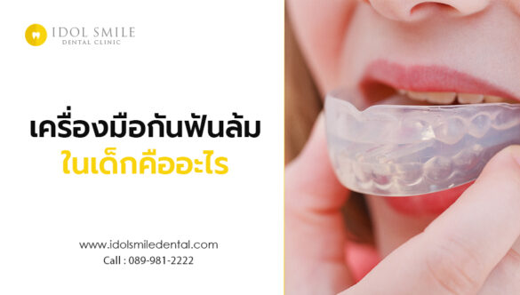 เครื่องมือกันฟันล้มในเด็ก คืออะไร 