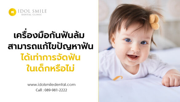 เครื่องมือกันฟันล้ม สามารถแก้ไขปัญหาฟันได้เท่าการจัดฟันในเด็กหรือไม่