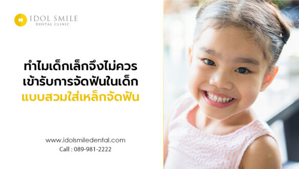 ทำไมเด็กเล็ก จึงไม่ควรเข้ารับการจัดฟันในเด็ก แบบสวมใส่เหล็กจัดฟัน