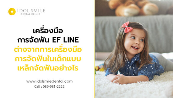เครื่องมือการจัดฟัน EF LINE ต่างจากการเครื่องมือการจัดฟันในเด็กแบบเหล็กจัดฟันอย่างไร