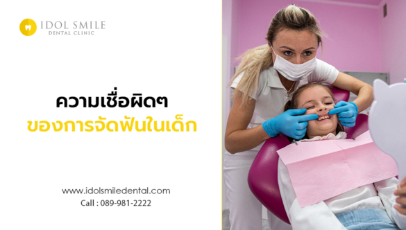 ความเชื่อผิดๆของการจัดฟันในเด็ก