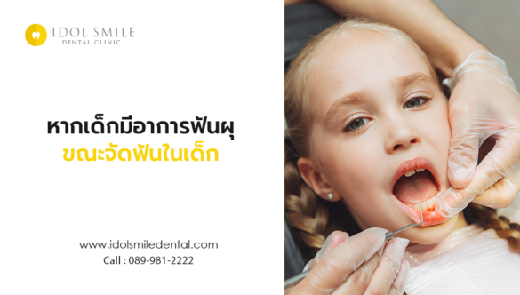 หากเด็กมีอาการฟันผุ ขณะจัดฟันในเด็ก