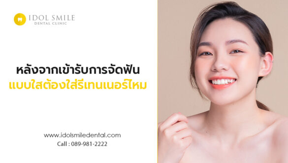 หลังจากเข้ารับการจัดฟันแบบใส ต้องใส่รีเทนเนอร์ไหม