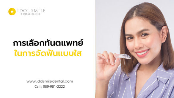 การเลือกทันตแพทย์ในการจัดฟันแบบใส