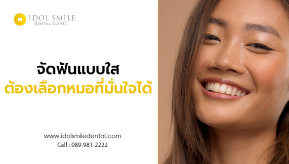 จัดฟันแบบใส ต้องเลือกหมอที่มั่นใจได้
