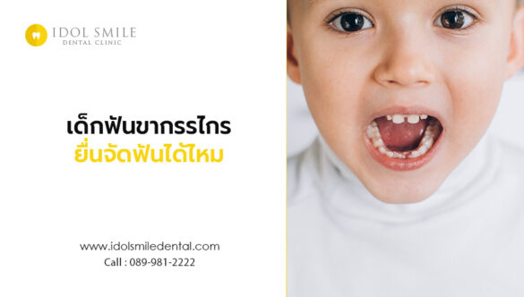เด็กฟันขากรรไกรยื่นจัดฟันได้ไหม