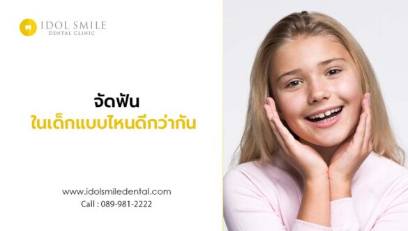 จัดฟันในเด็กแบบไหนดีกว่ากัน